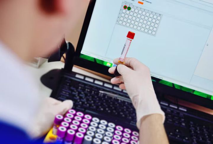 Complete Guide to IL-6 ELISA Kits: Insights, Usage, and Information