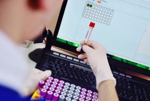 Complete Guide to IL-6 ELISA Kits: Insights, Usage, and Information